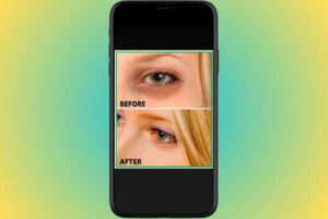 aplicativo-para-eliminar-olheiras-nas-fotos